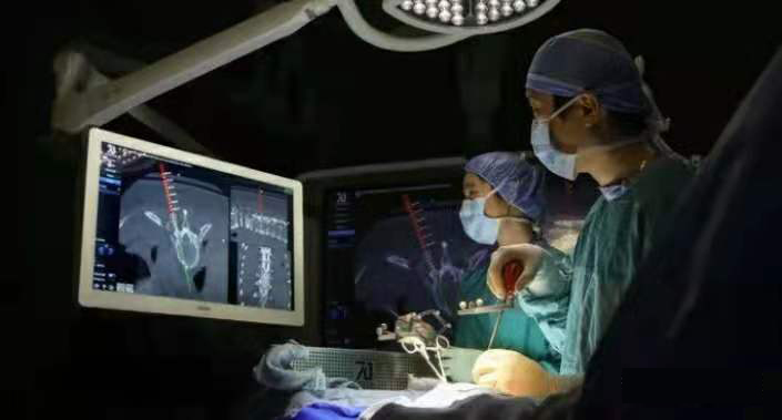 视觉引导脊柱外科手术.jpg